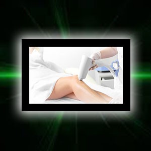 Quanto dura una seduta di epilazione laser, e quante sedute sono necessarie?