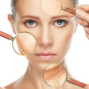Medicina estetica alla portata di tutti: il microbotox